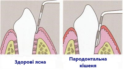 Здорові зуби