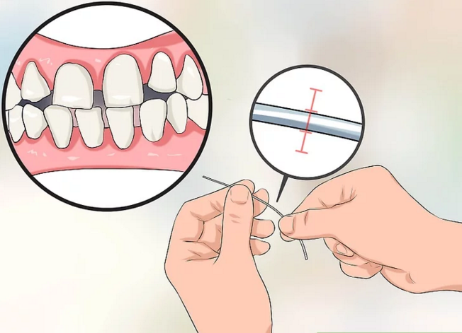 Зубна нитка для великих проміжків